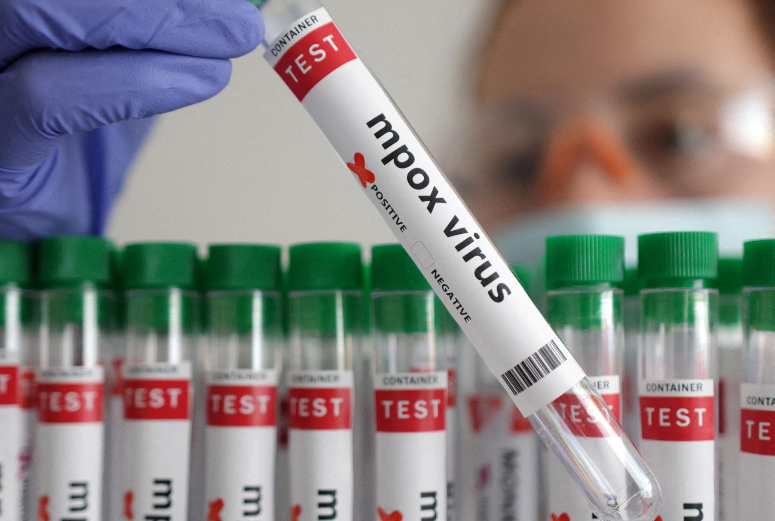 Alemania dona 100 millones de vacunas contra el mpox a África