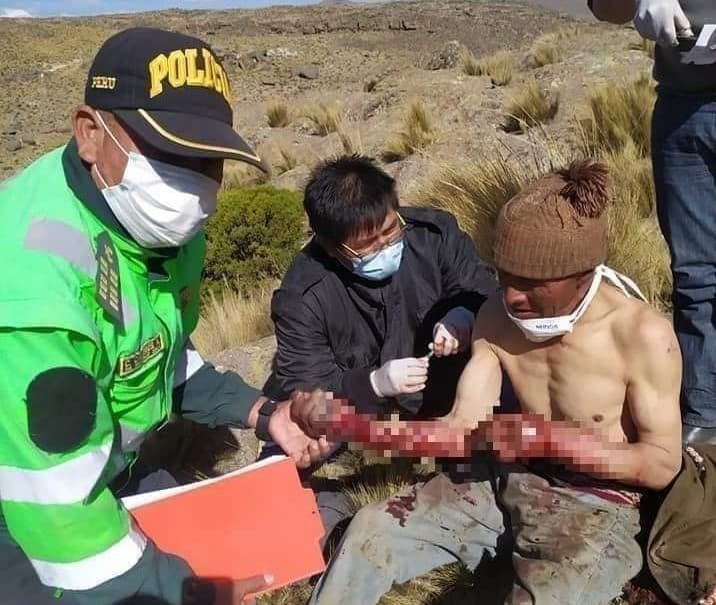 Arequipa: puma ataca a sexagenario en San Juan de Tarucani