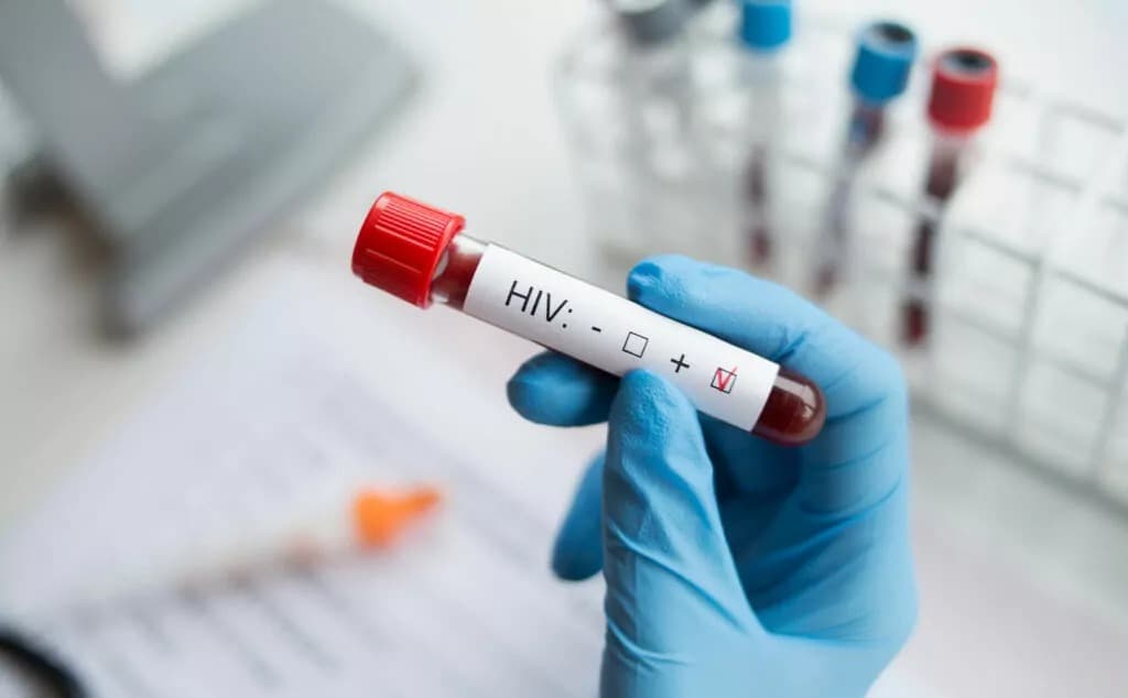 Logran primer caso de curación del VIH sin mutación protectora