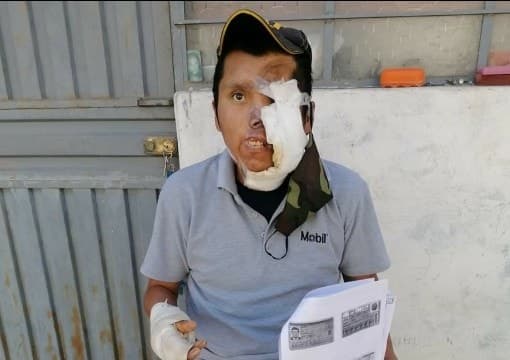 Formalizan investigación contra chofer que arrolló a heladero