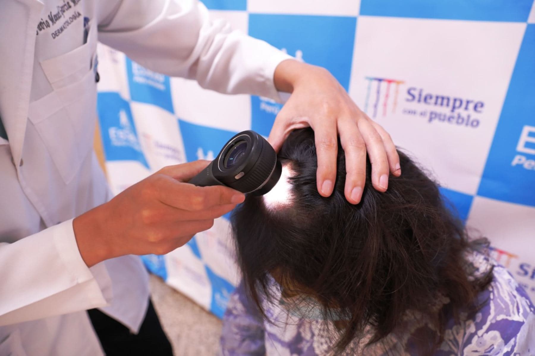 Un 60% de mujeres reportan caída del cabello tras COVID-19