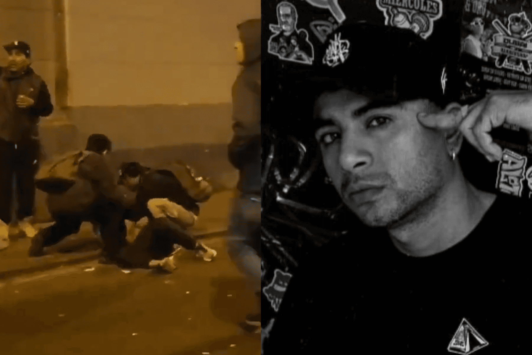 Problemas en la vesícula: “Cálculo detectado, cálculo operado”