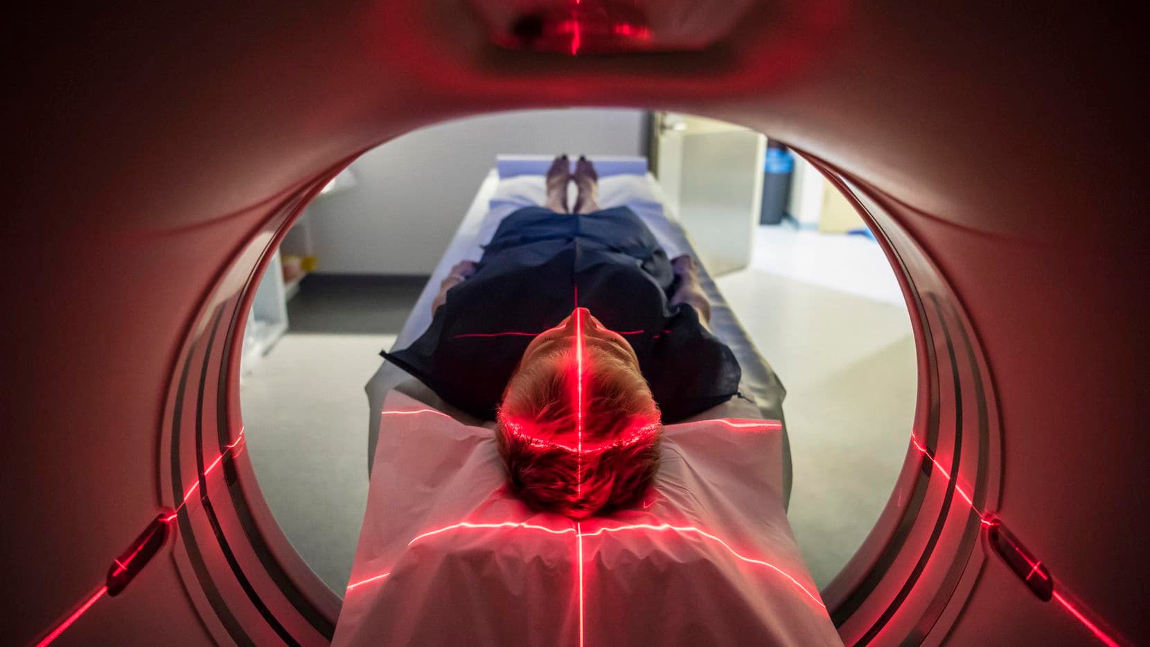 EsSalud: Unidad cardiovascular reduce muertes por infartos cerebrales